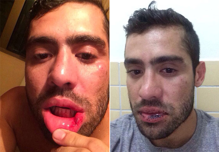 Mãe de Yuri, sobre suposta agressão: 