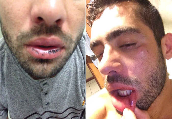 Mãe de Yuri, sobre suposta agressão: 