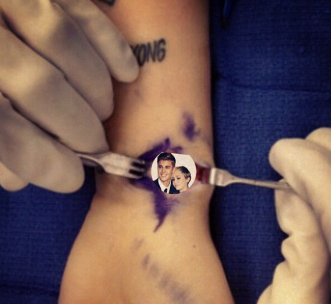 Miley Cyrus posta fotos engraçadas de sua cirurgia no pulso