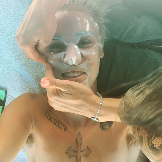 Antes do Grammy, Justin Bieber faz procedimento estético