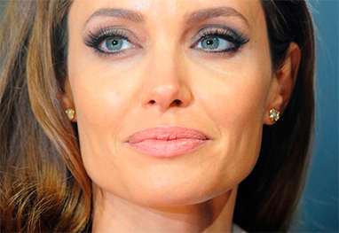 Médico alerta para os riscos de cirurgia preventiva feita por Angelina Jolie - Getty Images