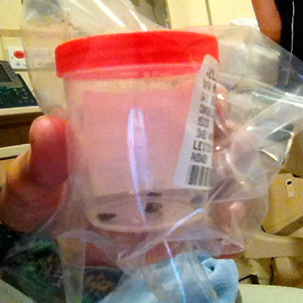 Luciano Camargo faz cirurgia para retirada da vesícula