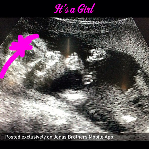 Kevin Jonas, do Jonas Brothers, será pai de uma menina