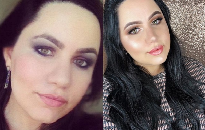 Bruna Tavares antes e depois
