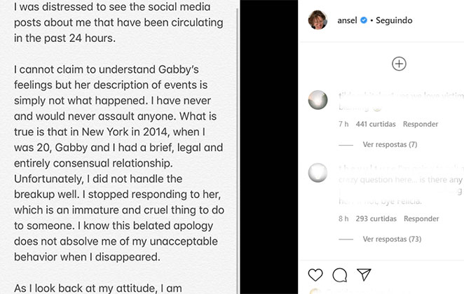 Ansel Elgort se defende de acusações de estupro