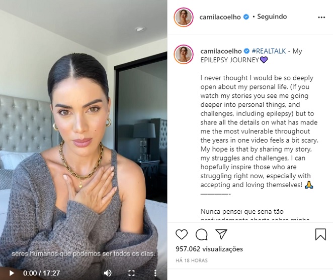 Camila Coelho faz vídeo emocionante sobre epilepsia 