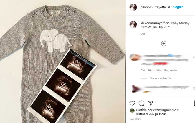 Deon Murray, ator de Harry Potter, anunciou que a namorada está grávida do primeiro filho deles