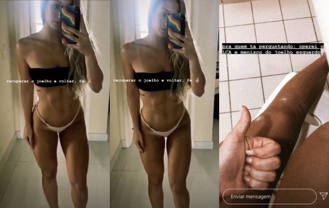 Bruna Griphao ostenta corpaço após cirurgia no joelho