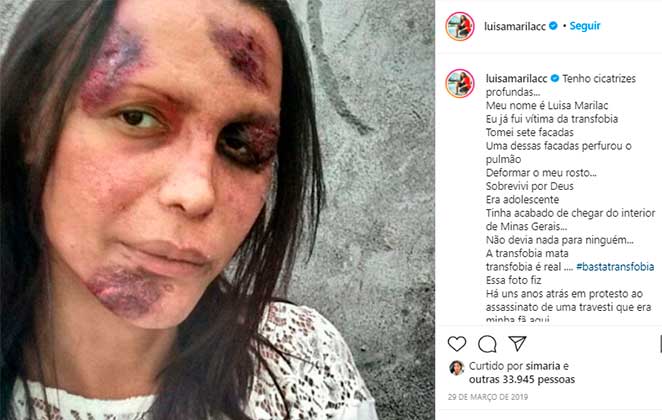Luísa Marilac desabafou sobre os ataques transfóbicos que sofreu durante sua vida