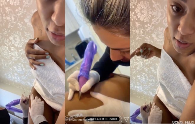 MC Rebecca faz camuflagem de estrias