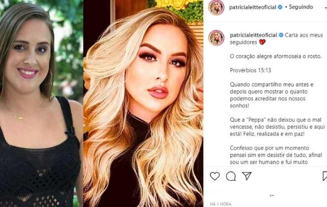 Patricia Leitte e seu antes e depois