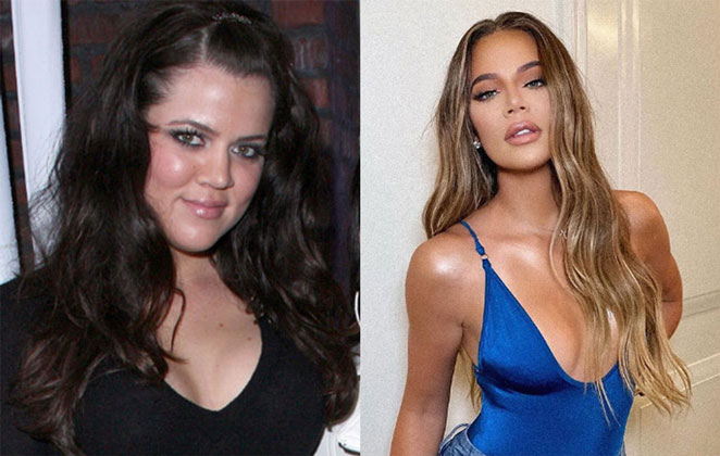 Confira o Antes e Depois do clã Kardashian-Jenner - O Fuxico