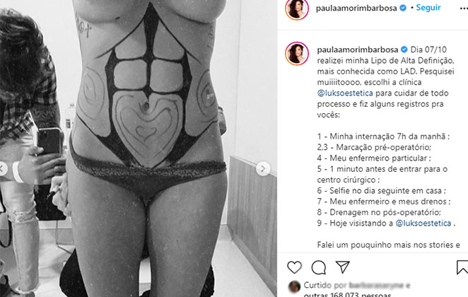 Paula Amorim exibe procedimento estético 