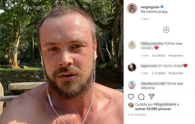 Sérgio Guizé e o resultado do seu transplante capilar