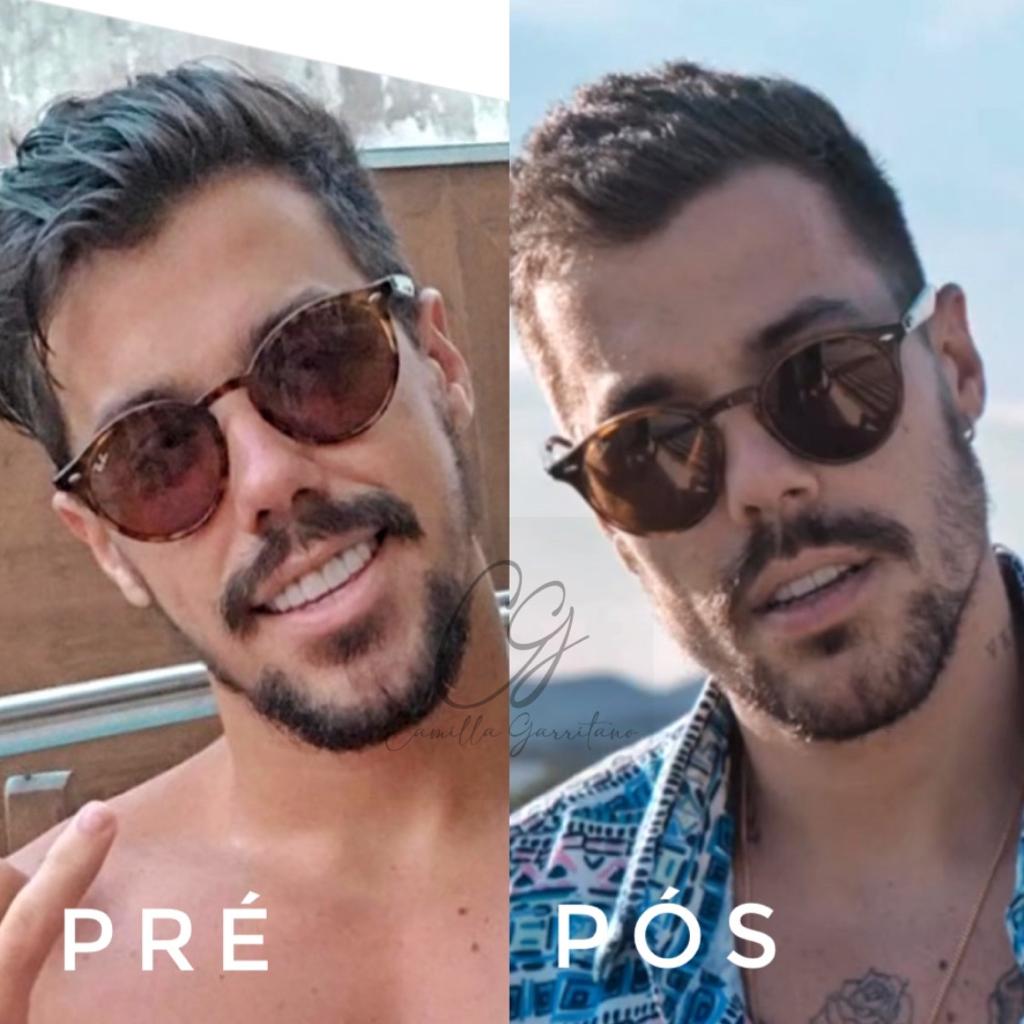 Você acha que Lipe mudou muito?