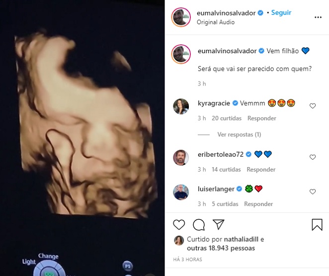 Malvino Salvador mostra rostinho do filho em ultrassom