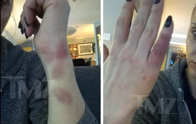 Ricci mostra marcas das agressões que teria sofrido do marido