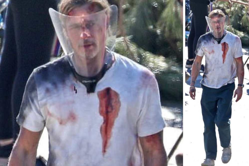 O ator de Bastardos Inglórios aparece todo ensanguentado, com mancha de sangue falso na camiseta e hematomas pelo corpo.