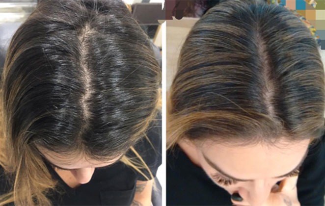 Dani Bolina realiza procedimento estético