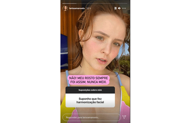 Larissa Manoela responde e nega que tenha feito harmonização facial
