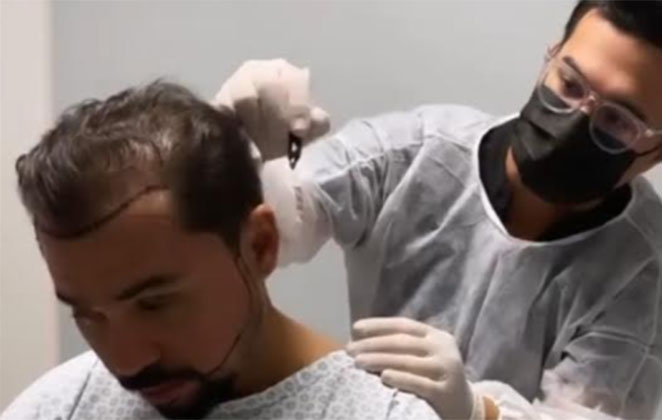 O músico Xand Avião no momento do procedimento estético