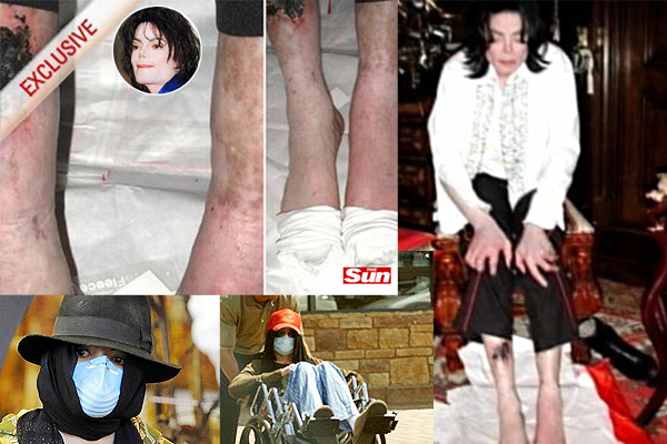 Autopsia De Michael Jackson
