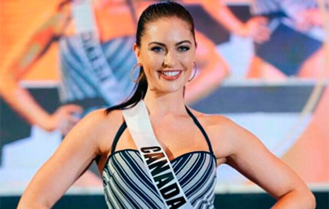 Miss Canadá defende orgulhosa suas curvas - OFuxico