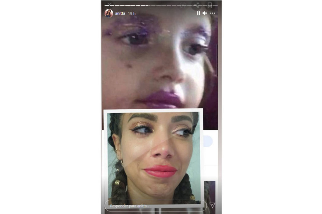 Fotomontagem de Anitta comparando selfie com imagem de meme de uma crianças com a maquiagem roxa borrada