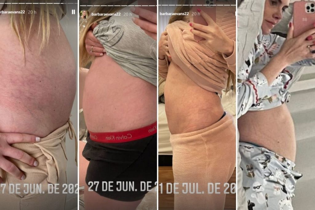 Fotomontagem com quatro fotografias da barriga de Bárbara Evans em diferentes dias