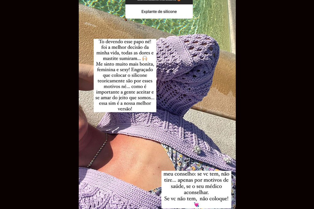 Fiorella Mattheis comenta sobre a decisão de retirar as próteses de silicone