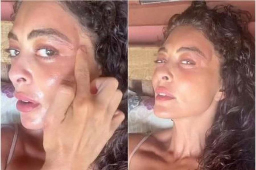 Juliana Paes mostra rosto inchado após ser picada por um mosquito