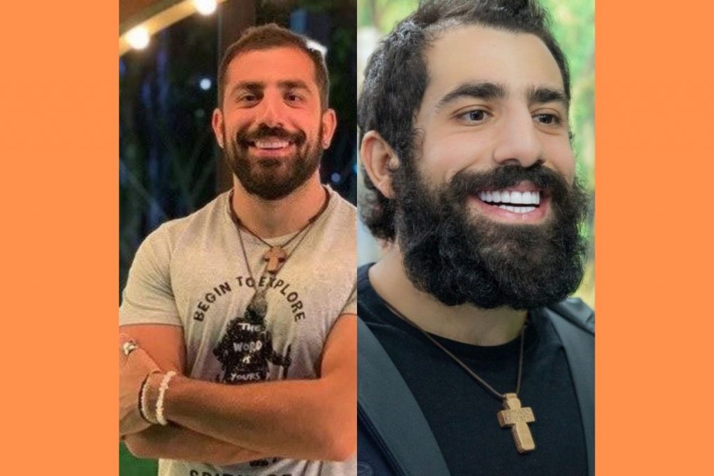 Kaysar Dadour mostra antes e depois dos dentes renovados
