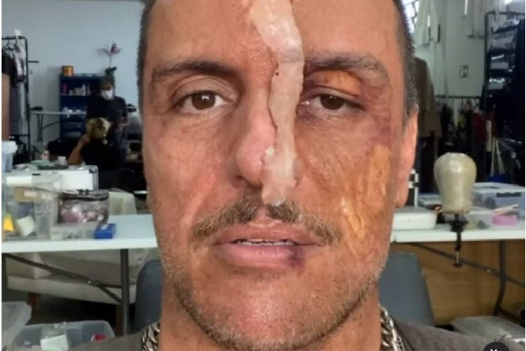 Rodrigo Lombardi rosto com cicatriz