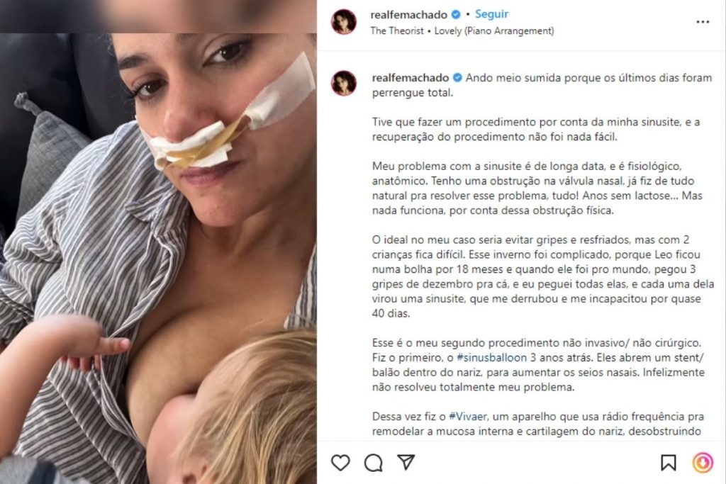 Post de Fernanda Machado sobre procedimento para tratar sinusite