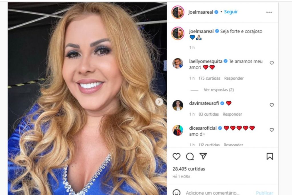 joelma publicando primeira foto após comentários de rosto inchado