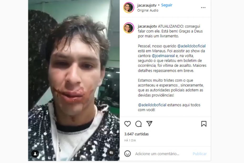Vídeo de Adeildo B machucado após ser roubado e agredido ao deixar show de Joelma