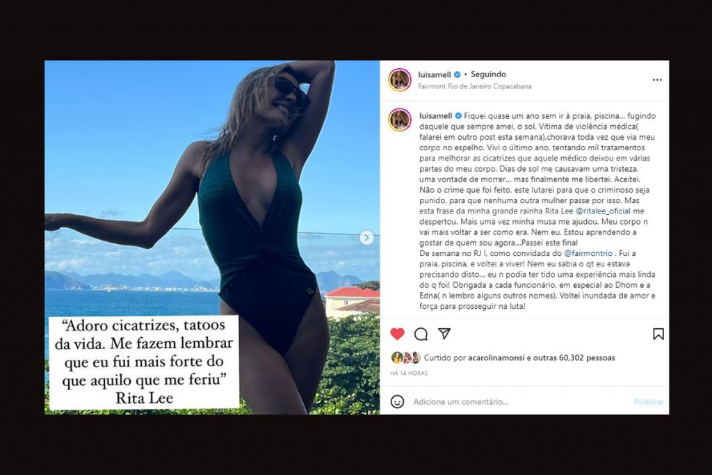 Luisa Mell volta à praia após sofrer violência médica