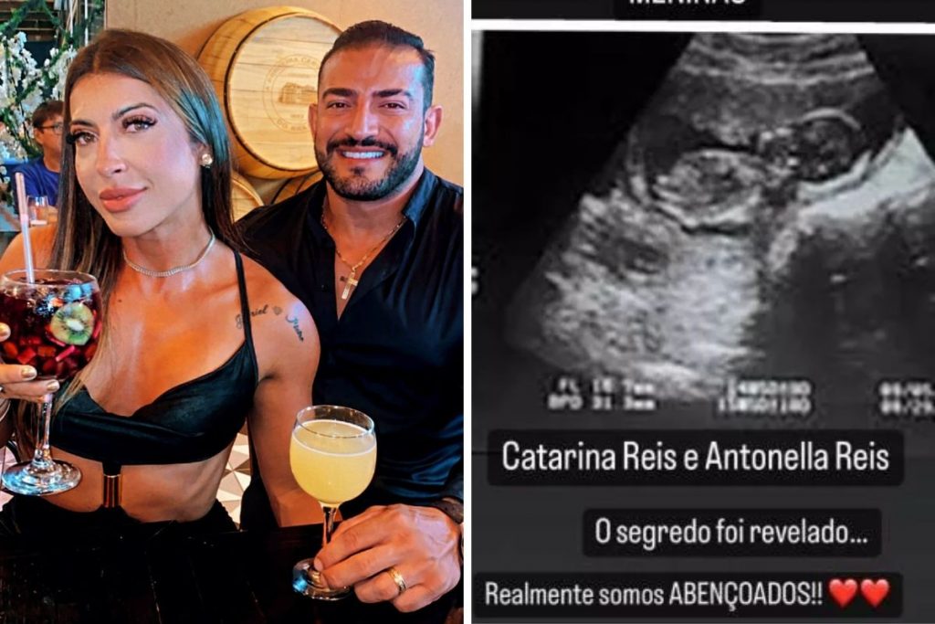 Priscila Pires revela ultrassom e nome das filhas