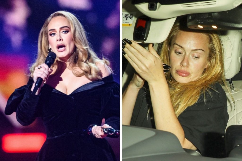 Adele levanta hipótese de preenchimento labial
