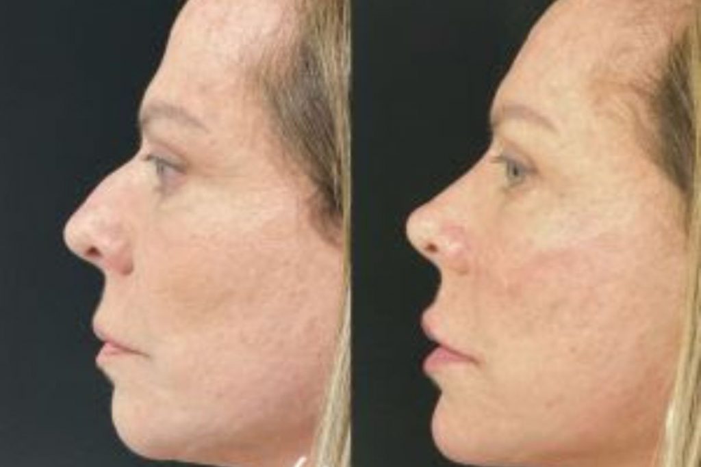 Christina Rocha fez rinomodelação