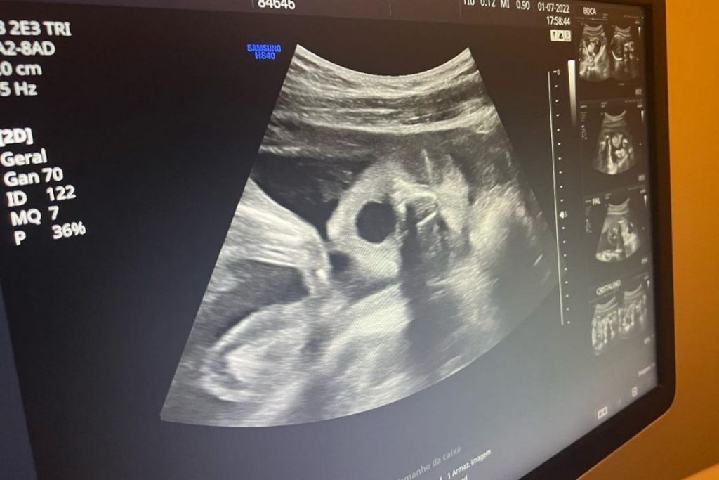 Virgínia Fonseca mostra ultrassom de Maria Flor