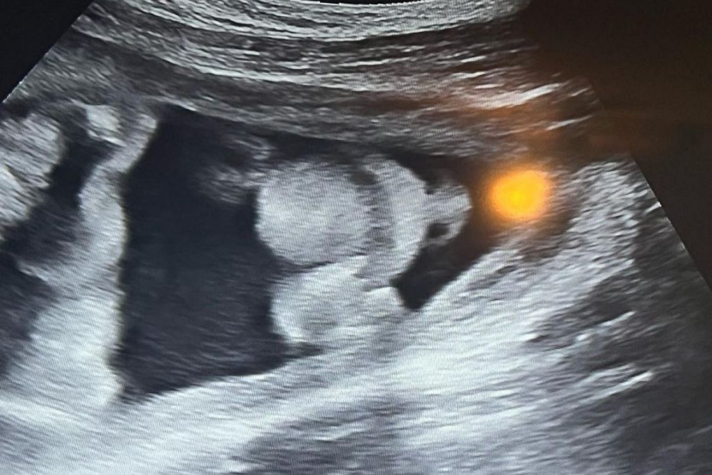 Virgínia Fonseca mostra ultrassom de Maria Flor