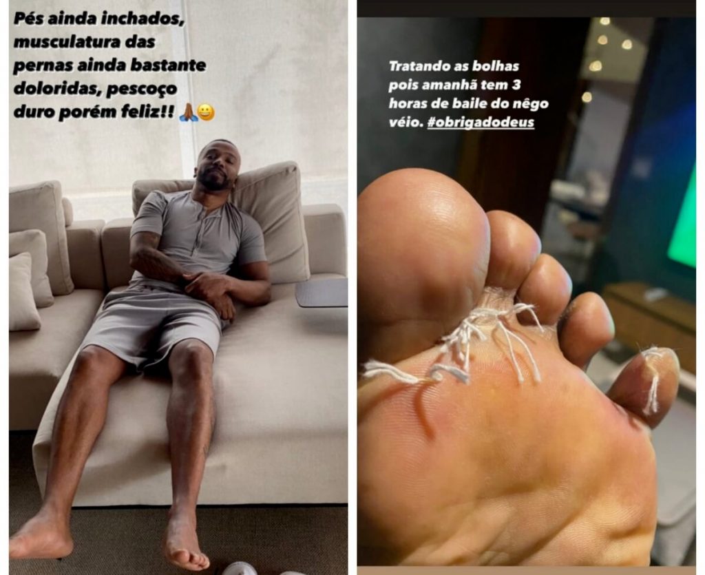 Alexandre Pires sentado no sopá, de bermuda e camisa, mostrando os pés inchados - detalhe do dedão do pé 