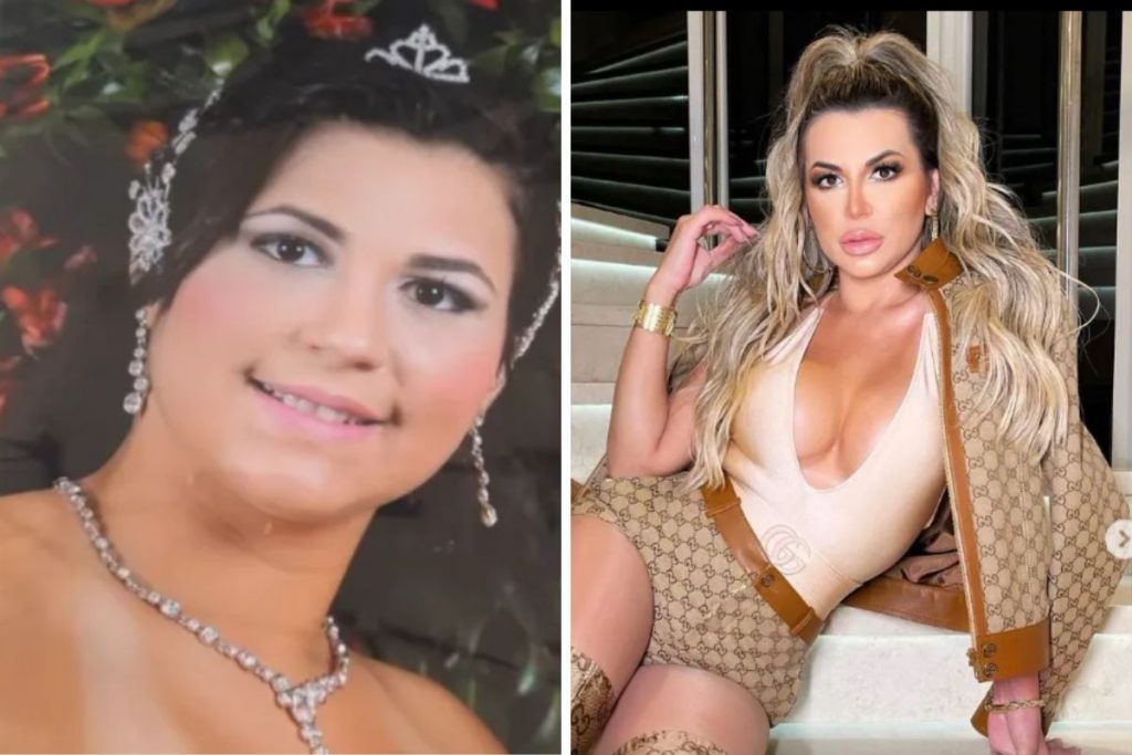 Deolane Bezerra antes e depois de procedimento estético