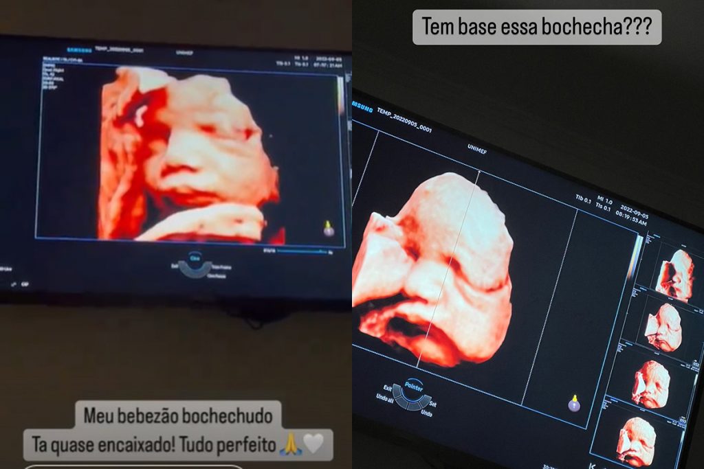 Gabriela Pugliesi mostra rosto do filho em ultrassom