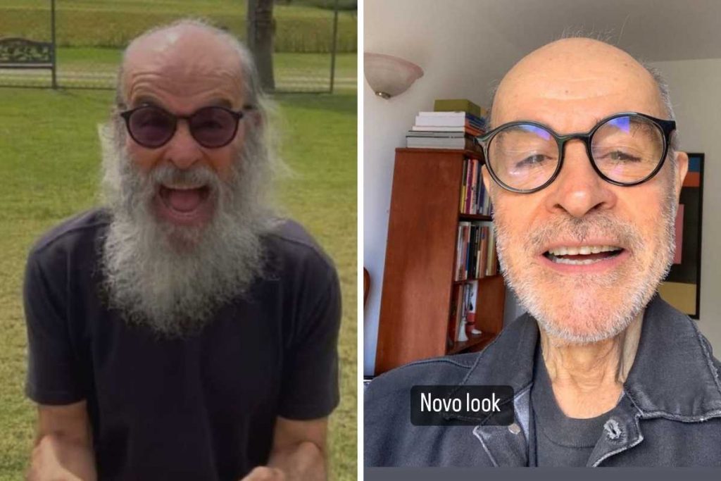 Antes e depois de Osmar Prado