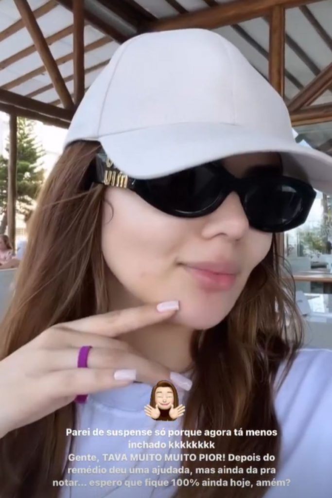 Post de Eslô Marques falando sobre a boca inchada