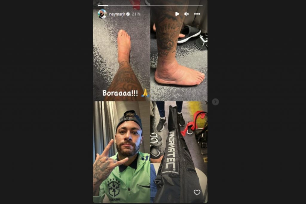Stories de Nyemar com tornozelo machucado no Instagram