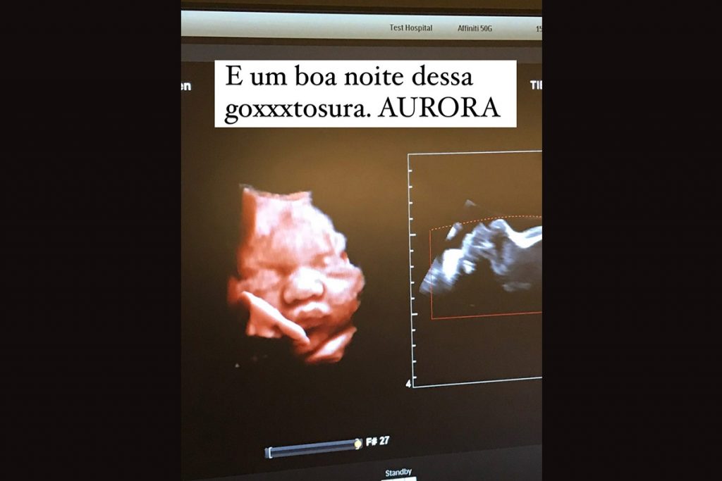 Cintia Dicker mostra ultrassom da filha Aurora