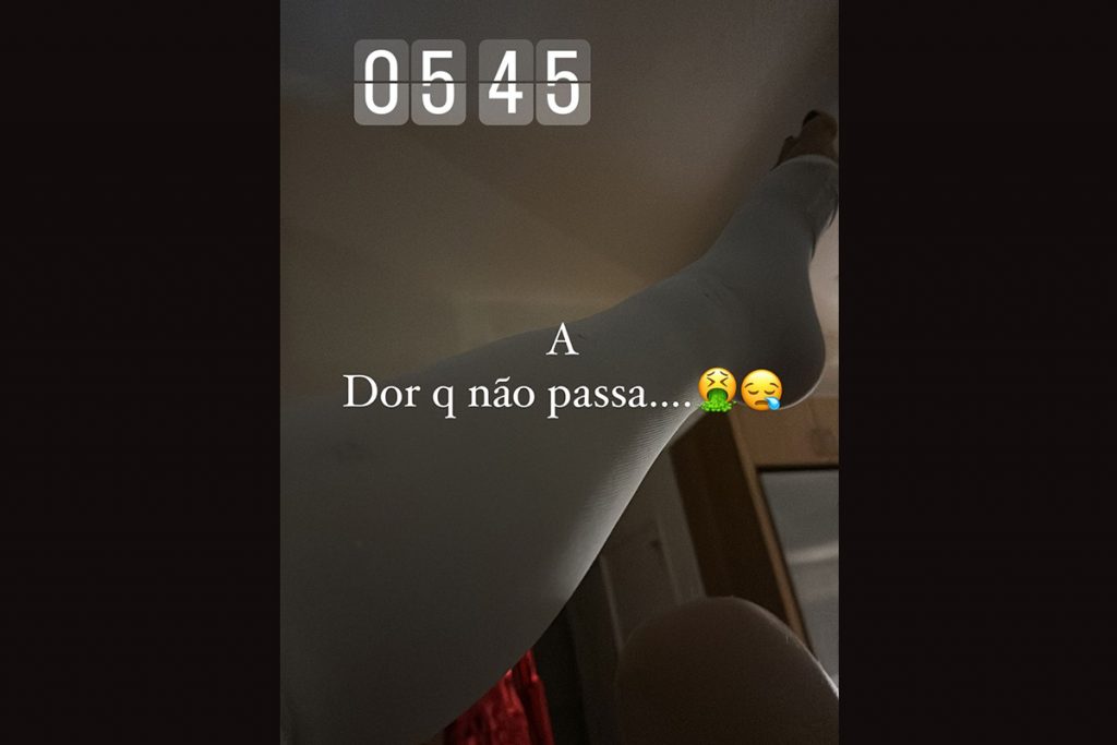 Luciana Gimenez desabafa após acidente